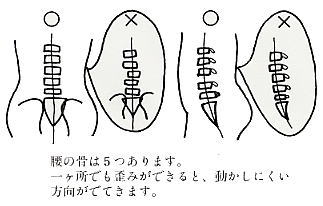 腰の骨の歪み